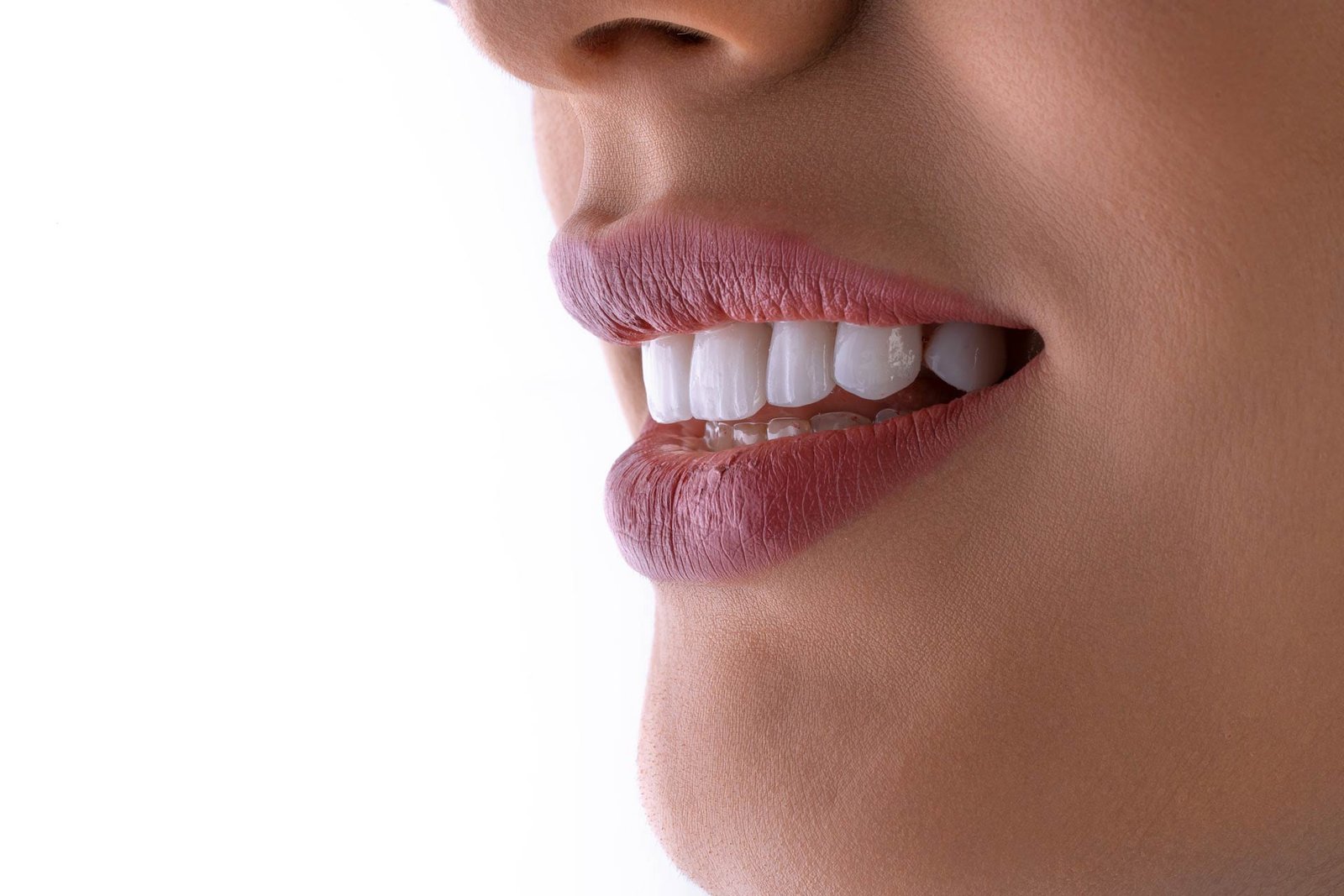 Linda foto de mulher sorrindo com fundo branco e luminoso, após o tratamento de ortodontia